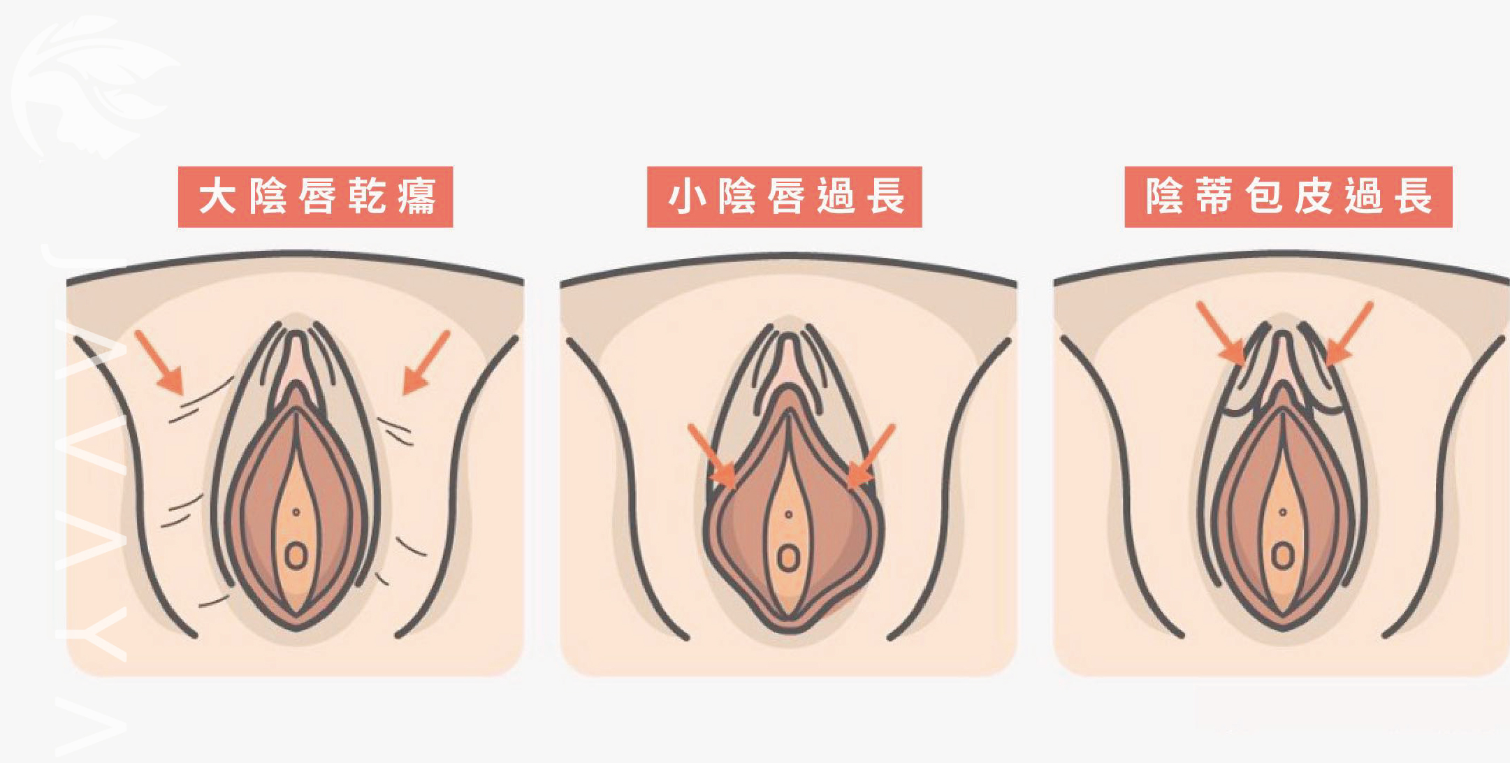 找 不 到 陰蒂