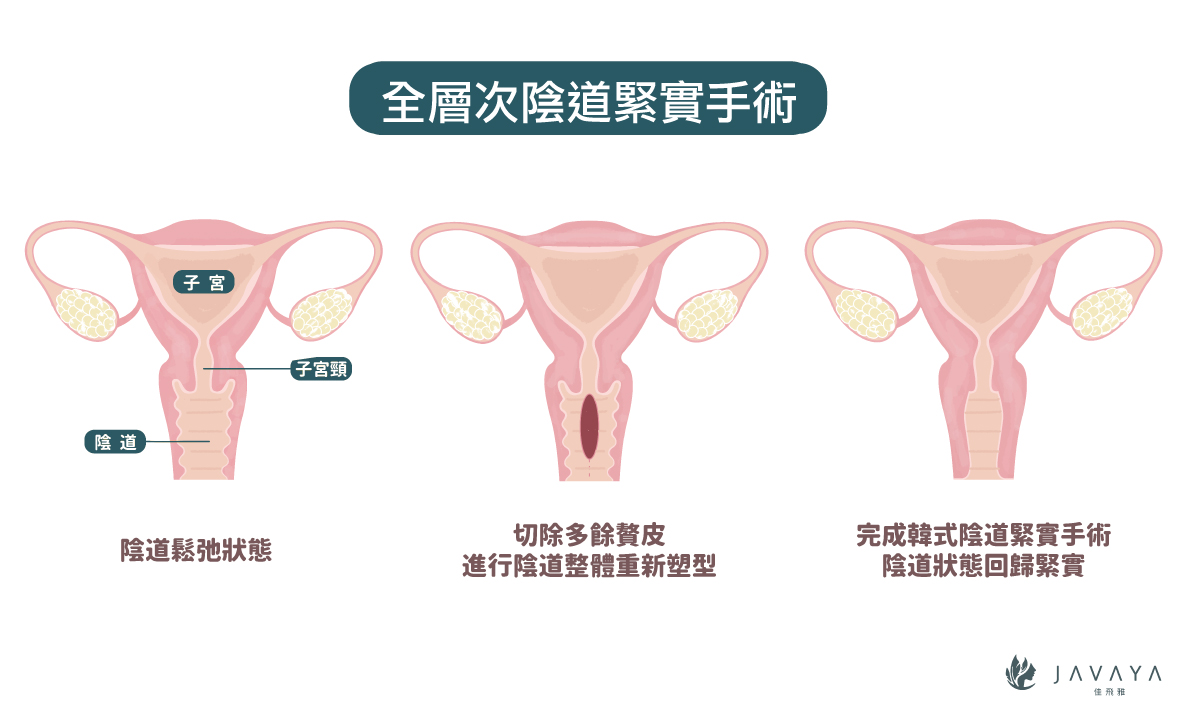 整形手術 佳飛雅醫美javaya Clinic